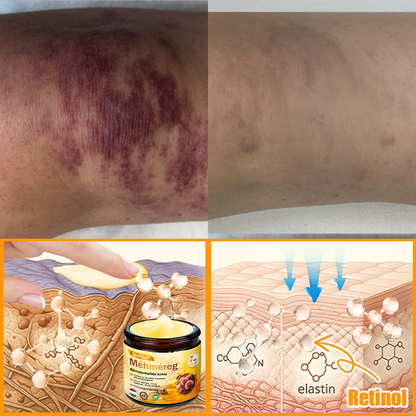 ⭐⭐ ZödVita® Méhméreg Bőr Helyreállító Krém (👨‍⚕‍CE jóváhagyott)👍✅