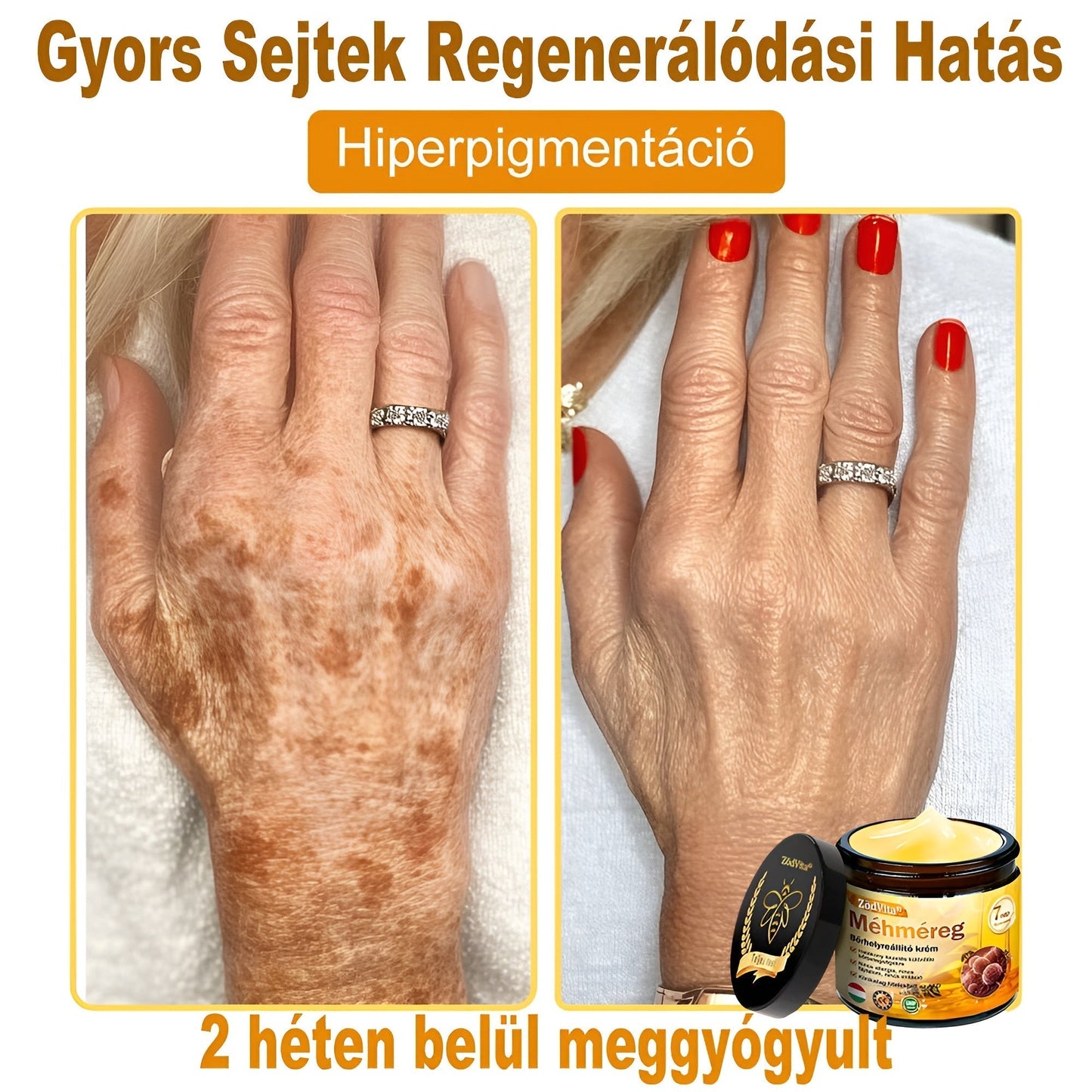 🐝🌿 Bőrgyógyász ajánlása ✨ ZödVita® Méhméreg Bőr Helyreállító Krém 🔥 Magyar fejlesztés, magyarországi gyártás és szállítás