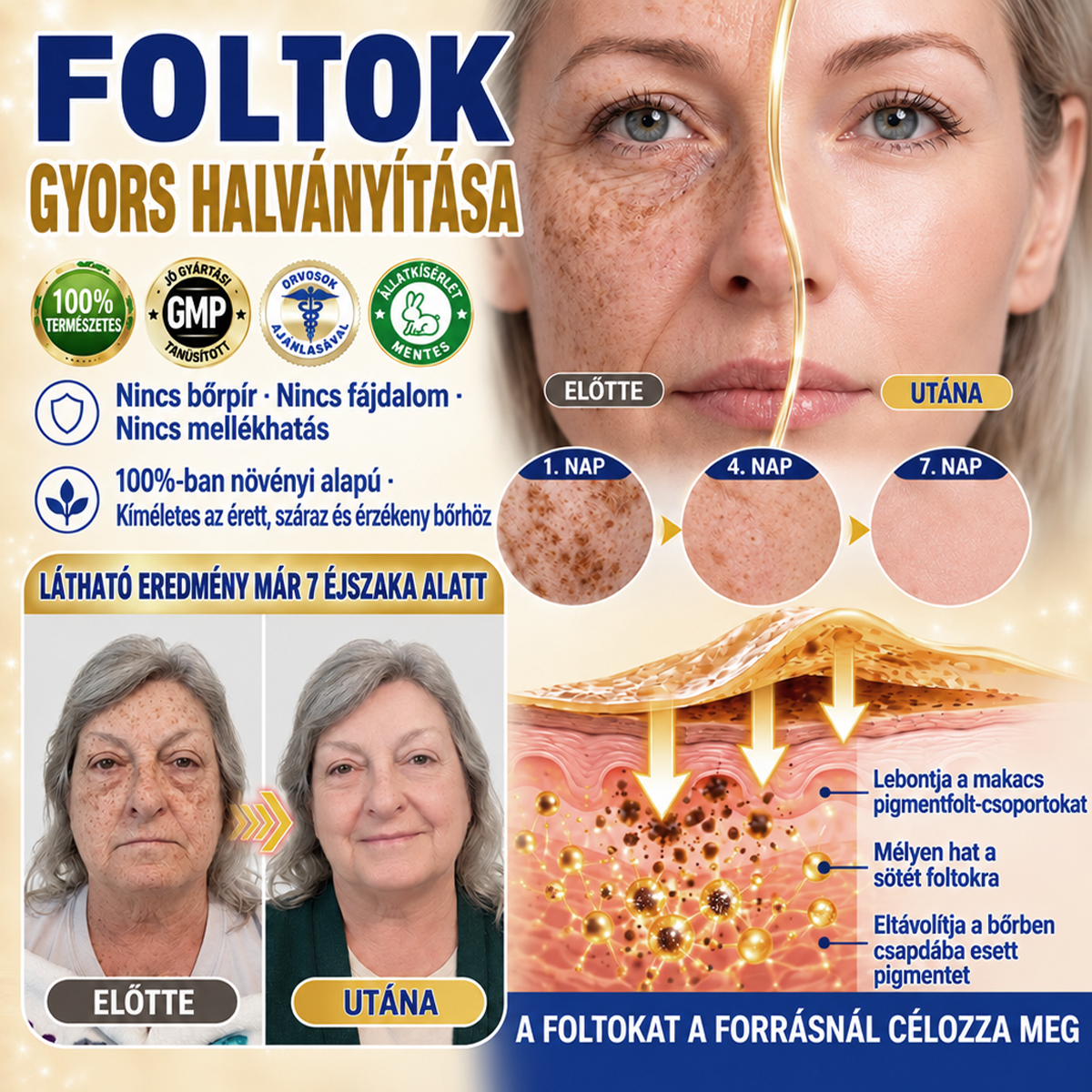 𝐌𝐞𝐝𝐢𝐬𝐭𝐚𝐫𝐭® 𝐊𝐮𝐫𝐤𝐮𝐦𝐚 × 𝐊𝐨𝐣𝐢𝐧𝐬𝐚𝐯 𝐄́𝐣𝐬𝐳𝐚𝐤𝐚𝐢 Bőrfiatalító 𝐊𝐫𝐞́𝐦— 𝐇𝐚𝐥𝐯𝐚́𝐧𝐲𝐢́𝐭𝐬𝐝 𝐚 𝐦𝐚𝐤𝐚𝐜𝐬 𝐬𝐨̈𝐭𝐞́𝐭 𝐟𝐨𝐥𝐭𝐨𝐤𝐚𝐭 𝐞́𝐬 𝐬𝐢𝐦𝐢́𝐭𝐬𝐝 𝐤𝐢 𝐚 𝐥𝐚́𝐭𝐡𝐚𝐭𝐨́ 𝐫𝐚́𝐧𝐜𝐨𝐤𝐚𝐭 𝐚𝐥𝐯𝐚́𝐬 𝐤𝐨̈𝐳𝐛𝐞𝐧 🌙 ✅ 𝐄́𝐣𝐬𝐳𝐚𝐤𝐚́𝐧𝐤𝐞́𝐧𝐭 𝐞𝐠𝐲 𝐥𝐞́𝐩𝐞́𝐬 · 𝐋𝐚́𝐭𝐡𝐚𝐭𝐨́ 𝐯𝐚́𝐥𝐭𝐨𝐳𝐚́𝐬 𝟕 𝐞́𝐣𝐬𝐳𝐚𝐤𝐚 𝐚𝐥𝐚𝐭𝐭