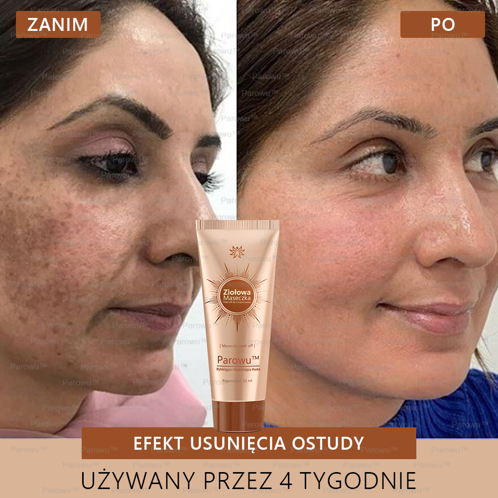 💟 Parowu™ Wybielająca i Rozjaśniająca Maska - Naturalne składniki trwale usuwają plamy, piegi i przebarwienia