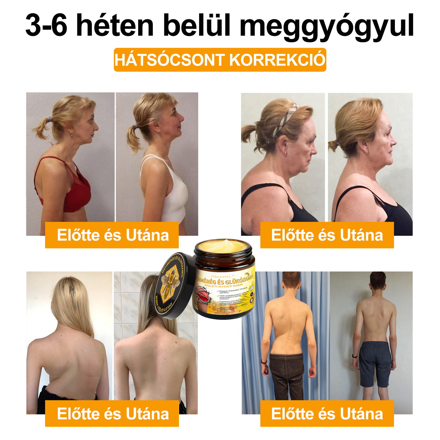 1️⃣ Gbpurity™ Méhmérég És Glükózamin Ízületi Gyógy Krém|TARTALMAZ MÉHMÉREG PEPTIDET, GLÜKÓZAMINT ÉS ARNIKÁT