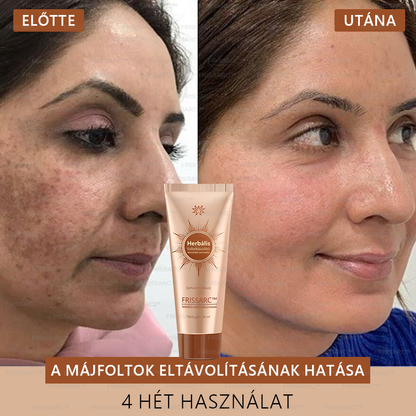 (40%-60% kedvezmény élvezete) 𝐅𝐑𝐈𝐒𝐒𝐀𝐑𝐂™ Fehérítő És Folteltávolító Arcmaszk - Természetes összetevők tartósan eltüntetik a foltokat, szeplőket és napfoltokat.