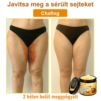 ⭐⭐ ZödVita® Méhméreg Bőr Helyreállító Krém (👨‍⚕‍CE jóváhagyott)👍✅