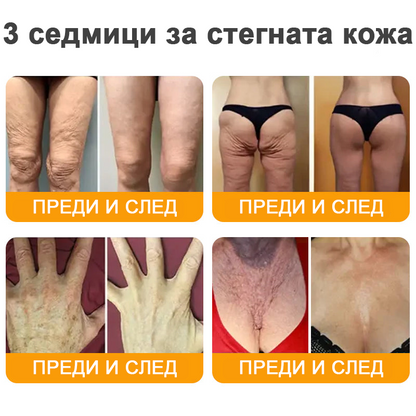 REHELY® Крем с пчелна отрова за регенерация на кожата – Подходящ за всички възрасти и типове кожа)