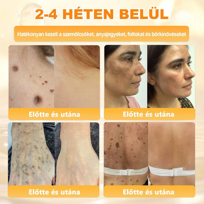 🔥🔥🔥 PuraCure® Méhméreg Bőr Helyreállító Krém (👨‍⚕‍CE Tanúsítvány)👍✅