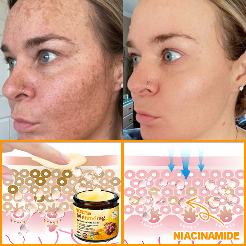 🐝🌿 ZödVita® Méhméreg Bőr Helyreállító Krém (👨‍⚕‍CE Tanúsítvány)👍✅