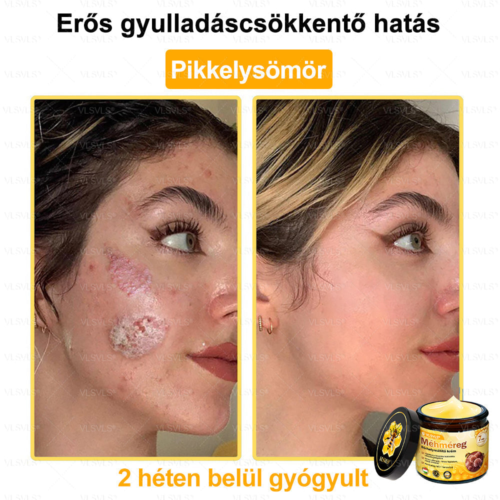 ✨✨✨💪VLSVLS® Méhméreg Bőrhelyreállító Krém (👨‍⚕‍CE jóváhagyott)👍✅