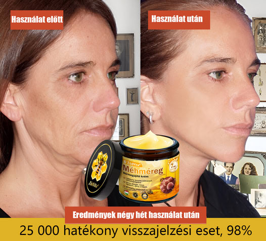🐝🌿 Bőrgyógyász ajánlása ✨ ZödVita® Méhméreg Bőr Helyreállító Krém 🔥 Magyar fejlesztés, magyarországi gyártás és szállítás
