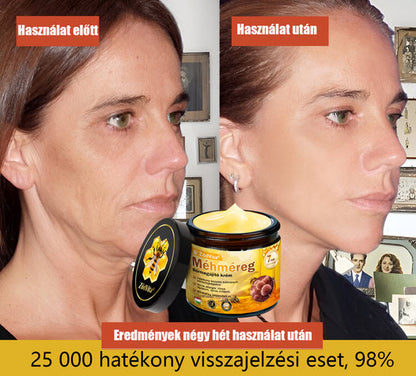 🐝🌿 Bőrgyógyász ajánlása ✨ ZödVita® Méhméreg Bőr Helyreállító Krém 🔥 Magyar fejlesztés, magyarországi gyártás és szállítás