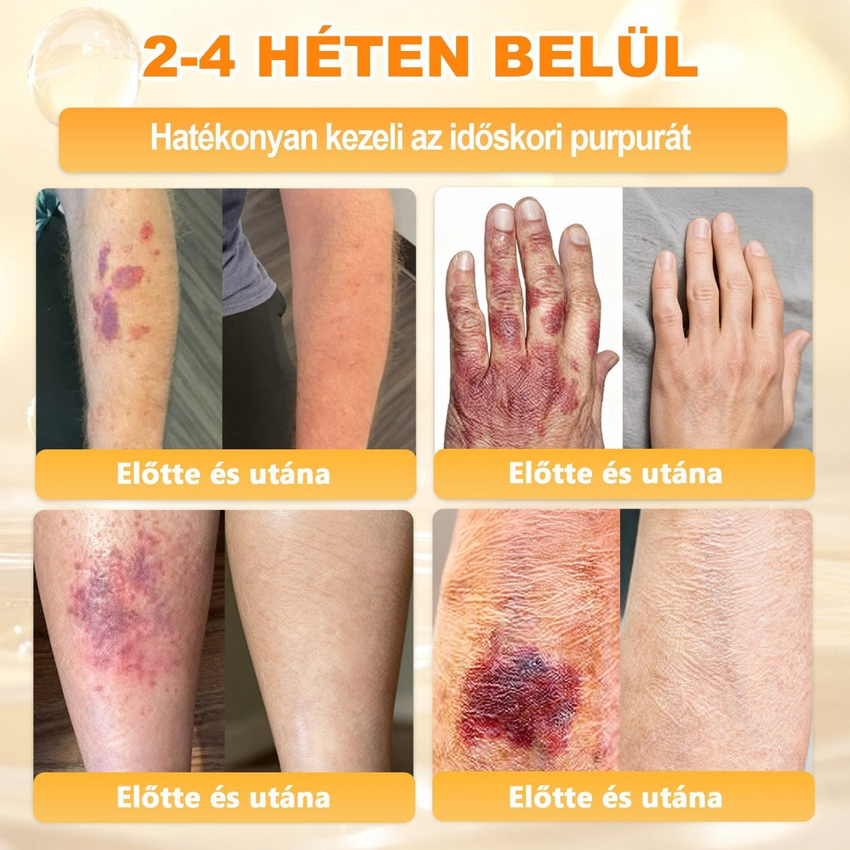 🔥🔥🔥 PuraCure® Méhméreg Bőr Helyreállító Krém (👨‍⚕‍CE Tanúsítvány)👍✅