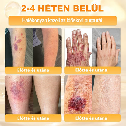 🔥🔥🔥 PuraCure® Méhméreg Bőr Helyreállító Krém (👨‍⚕‍CE Tanúsítvány)👍✅
