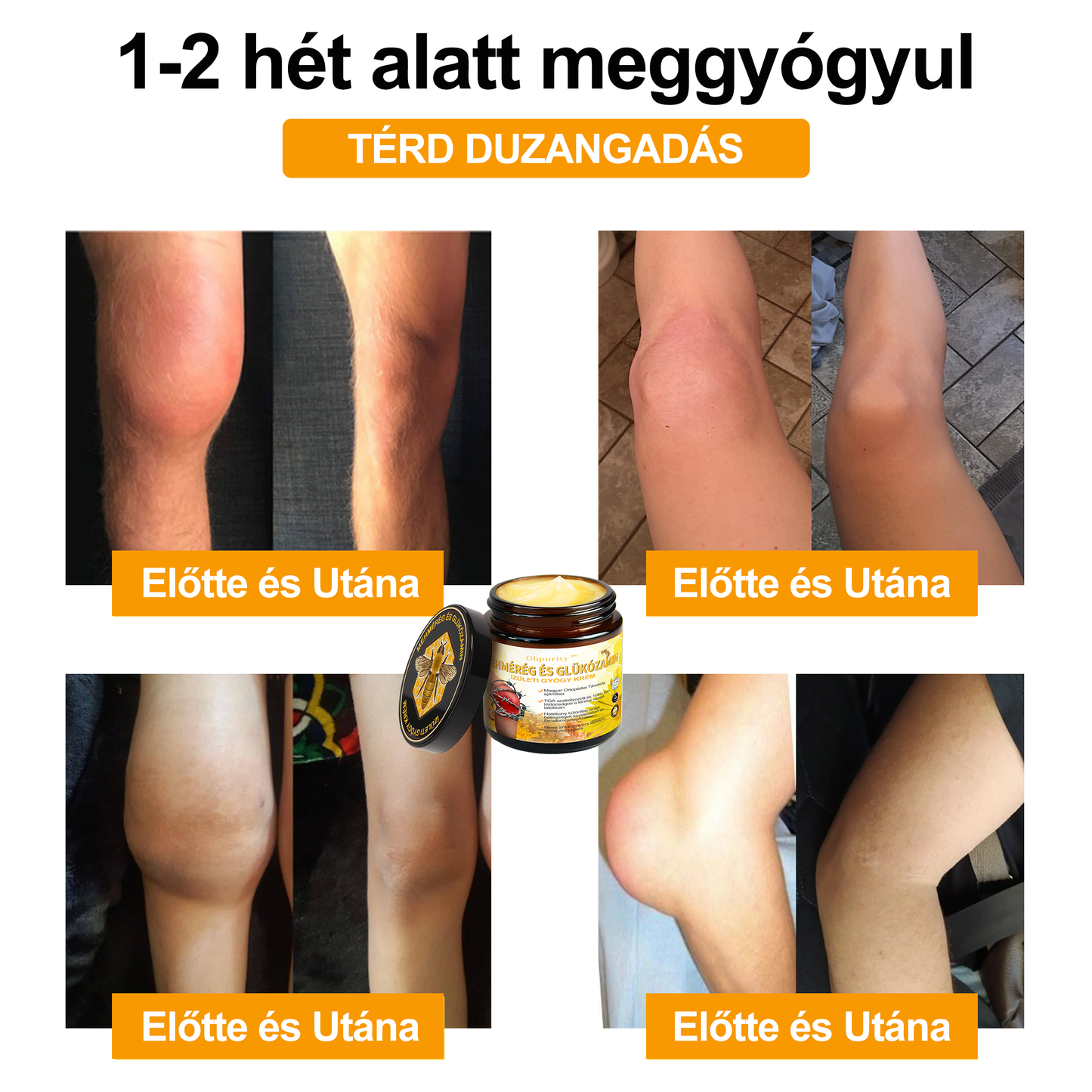 1️⃣ Gbpurity™ Méhmérég És Glükózamin Ízületi Gyógy Krém|TARTALMAZ MÉHMÉREG PEPTIDET, GLÜKÓZAMINT ÉS ARNIKÁT