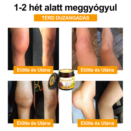 1️⃣ Gbpurity™ Méhmérég És Glükózamin Ízületi Gyógy Krém|TARTALMAZ MÉHMÉREG PEPTIDET, GLÜKÓZAMINT ÉS ARNIKÁT
