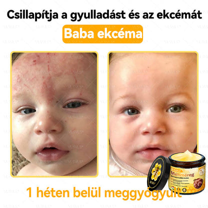 ✨✨✨💪VLSVLS® Méhméreg Bőrhelyreállító Krém (👨‍⚕‍CE jóváhagyott)👍✅