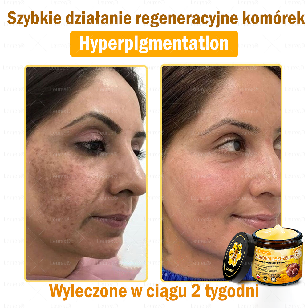 PL✨Leurea® Jad Pszczeli Regeneracja Skóry Krem🔥 Naturalna regeneracja skóry, wygładzenie zmarszczek i promienna cera-50 ml