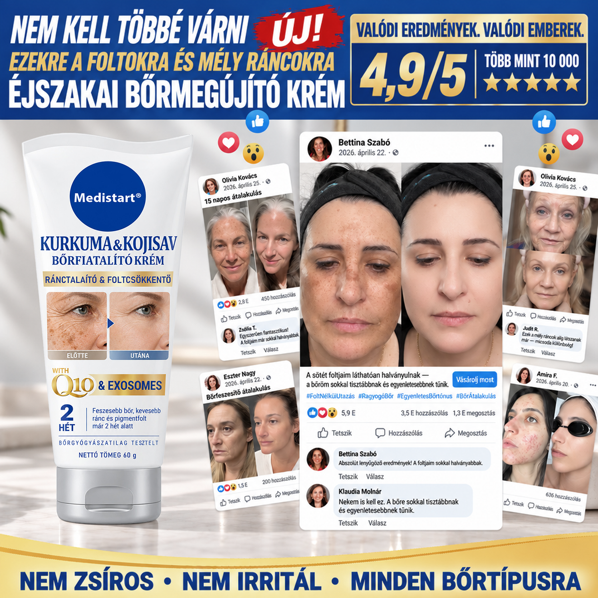 𝐌𝐞𝐝𝐢𝐬𝐭𝐚𝐫𝐭® 𝐊𝐮𝐫𝐤𝐮𝐦𝐚 × 𝐊𝐨𝐣𝐢𝐧𝐬𝐚𝐯 𝐄́𝐣𝐬𝐳𝐚𝐤𝐚𝐢 Bőrfiatalító 𝐊𝐫𝐞́𝐦— 𝐇𝐚𝐥𝐯𝐚́𝐧𝐲𝐢́𝐭𝐬𝐝 𝐚 𝐦𝐚𝐤𝐚𝐜𝐬 𝐬𝐨̈𝐭𝐞́𝐭 𝐟𝐨𝐥𝐭𝐨𝐤𝐚𝐭 𝐞́𝐬 𝐬𝐢𝐦𝐢́𝐭𝐬𝐝 𝐤𝐢 𝐚 𝐥𝐚́𝐭𝐡𝐚𝐭𝐨́ 𝐫𝐚́𝐧𝐜𝐨𝐤𝐚𝐭 𝐚𝐥𝐯𝐚́𝐬 𝐤𝐨̈𝐳𝐛𝐞𝐧 🌙 ✅ 𝐄́𝐣𝐬𝐳𝐚𝐤𝐚́𝐧𝐤𝐞́𝐧𝐭 𝐞𝐠𝐲 𝐥𝐞́𝐩𝐞́𝐬 · 𝐋𝐚́𝐭𝐡𝐚𝐭𝐨́ 𝐯𝐚́𝐥𝐭𝐨𝐳𝐚́𝐬 𝟕 𝐞́𝐣𝐬𝐳𝐚𝐤𝐚 𝐚𝐥𝐚𝐭𝐭