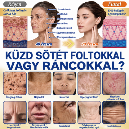 𝐌𝐞𝐝𝐢𝐬𝐭𝐚𝐫𝐭® 𝐊𝐮𝐫𝐤𝐮𝐦𝐚 × 𝐊𝐨𝐣𝐢𝐧𝐬𝐚𝐯 𝐄́𝐣𝐬𝐳𝐚𝐤𝐚𝐢 Bőrfiatalító 𝐊𝐫𝐞́𝐦— 𝐇𝐚𝐥𝐯𝐚́𝐧𝐲𝐢́𝐭𝐬𝐝 𝐚 𝐦𝐚𝐤𝐚𝐜𝐬 𝐬𝐨̈𝐭𝐞́𝐭 𝐟𝐨𝐥𝐭𝐨𝐤𝐚𝐭 𝐞́𝐬 𝐬𝐢𝐦𝐢́𝐭𝐬𝐝 𝐤𝐢 𝐚 𝐥𝐚́𝐭𝐡𝐚𝐭𝐨́ 𝐫𝐚́𝐧𝐜𝐨𝐤𝐚𝐭 𝐚𝐥𝐯𝐚́𝐬 𝐤𝐨̈𝐳𝐛𝐞𝐧 🌙 ✅ 𝐄́𝐣𝐬𝐳𝐚𝐤𝐚́𝐧𝐤𝐞́𝐧𝐭 𝐞𝐠𝐲 𝐥𝐞́𝐩𝐞́𝐬 · 𝐋𝐚́𝐭𝐡𝐚𝐭𝐨́ 𝐯𝐚́𝐥𝐭𝐨𝐳𝐚́𝐬 𝟕 𝐞́𝐣𝐬𝐳𝐚𝐤𝐚 𝐚𝐥𝐚𝐭𝐭
