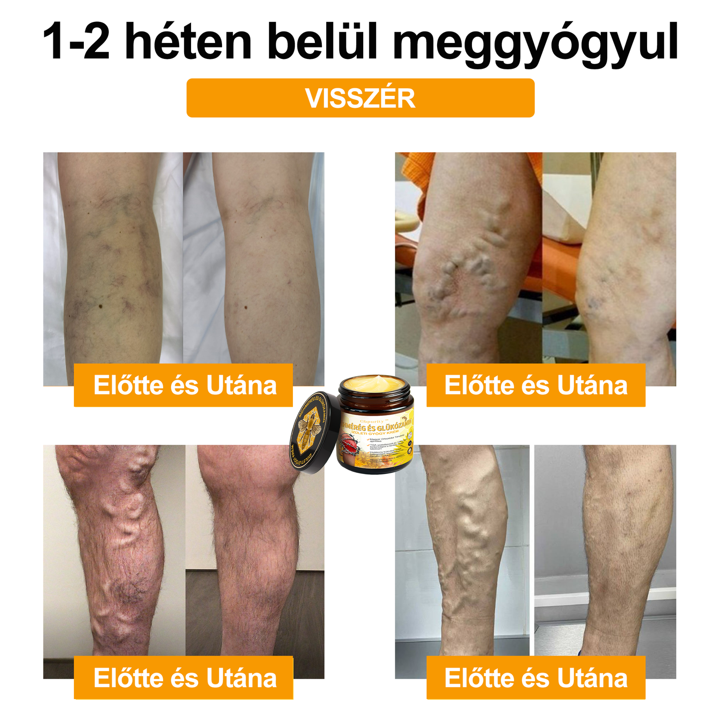 1️⃣ Gbpurity™ Méhmérég És Glükózamin Ízületi Gyógy Krém|TARTALMAZ MÉHMÉREG PEPTIDET, GLÜKÓZAMINT ÉS ARNIKÁT