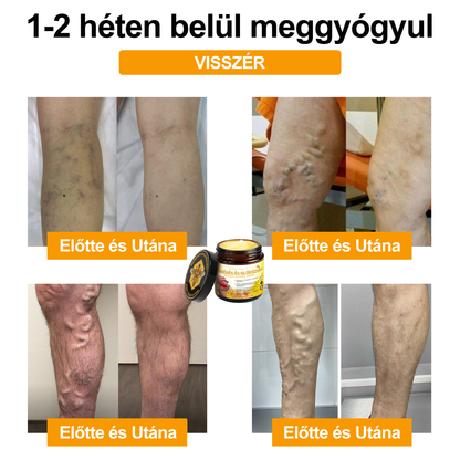 1️⃣ Gbpurity™ Méhmérég És Glükózamin Ízületi Gyógy Krém|TARTALMAZ MÉHMÉREG PEPTIDET, GLÜKÓZAMINT ÉS ARNIKÁT