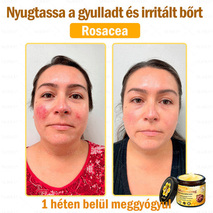 ✨✨✨💪VLSVLS® Méhméreg Bőrhelyreállító Krém (👨‍⚕‍CE jóváhagyott)👍✅
