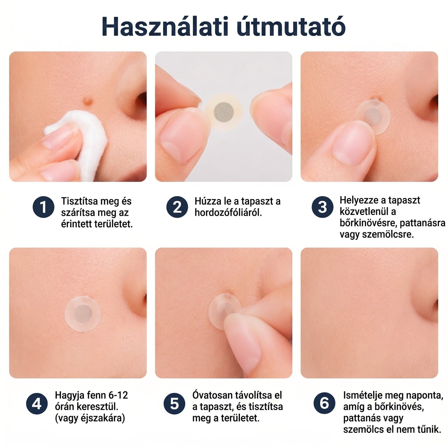🌟 PuraCure® 2 az 1-ben mikrotűs és hidrokolloid tapasz🧑‍⚕️ | Kiálló anyajegyek, aknék, lapos szemölcsök és bőrnövedékek eltávolítására | Segít csökkenteni a ráncokat, hegeket és bőrhibákat | Láthatatlan tapasz az arcra és testre
