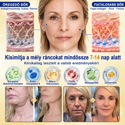 𝐌𝐞𝐝𝐢𝐬𝐭𝐚𝐫𝐭® 𝐊𝐮𝐫𝐤𝐮𝐦𝐚 × 𝐊𝐨𝐣𝐢𝐧𝐬𝐚𝐯 𝐄́𝐣𝐬𝐳𝐚𝐤𝐚𝐢 Bőrfiatalító 𝐊𝐫𝐞́𝐦— 𝐇𝐚𝐥𝐯𝐚́𝐧𝐲𝐢́𝐭𝐬𝐝 𝐚 𝐦𝐚𝐤𝐚𝐜𝐬 𝐬𝐨̈𝐭𝐞́𝐭 𝐟𝐨𝐥𝐭𝐨𝐤𝐚𝐭 𝐞́𝐬 𝐬𝐢𝐦𝐢́𝐭𝐬𝐝 𝐤𝐢 𝐚 𝐥𝐚́𝐭𝐡𝐚𝐭𝐨́ 𝐫𝐚́𝐧𝐜𝐨𝐤𝐚𝐭 𝐚𝐥𝐯𝐚́𝐬 𝐤𝐨̈𝐳𝐛𝐞𝐧 🌙 ✅ 𝐄́𝐣𝐬𝐳𝐚𝐤𝐚́𝐧𝐤𝐞́𝐧𝐭 𝐞𝐠𝐲 𝐥𝐞́𝐩𝐞́𝐬 · 𝐋𝐚́𝐭𝐡𝐚𝐭𝐨́ 𝐯𝐚́𝐥𝐭𝐨𝐳𝐚́𝐬 𝟕 𝐞́𝐣𝐬𝐳𝐚𝐤𝐚 𝐚𝐥𝐚𝐭𝐭