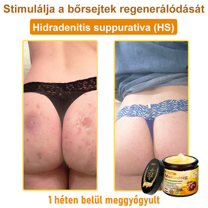⭐⭐ ZödVita® Méhméreg Bőr Helyreállító Krém (👨‍⚕‍CE jóváhagyott)👍✅