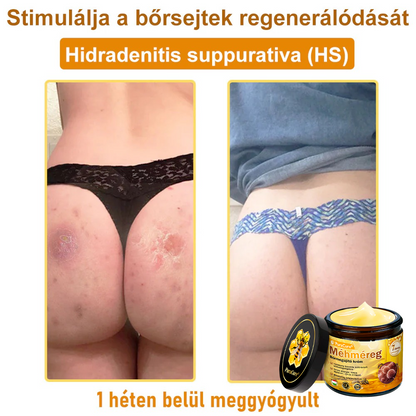 🌟 PuraCure® Méhméreg Bőr Helyreállító Krém (👨‍⚕‍CE Tanúsítvány)👍✅