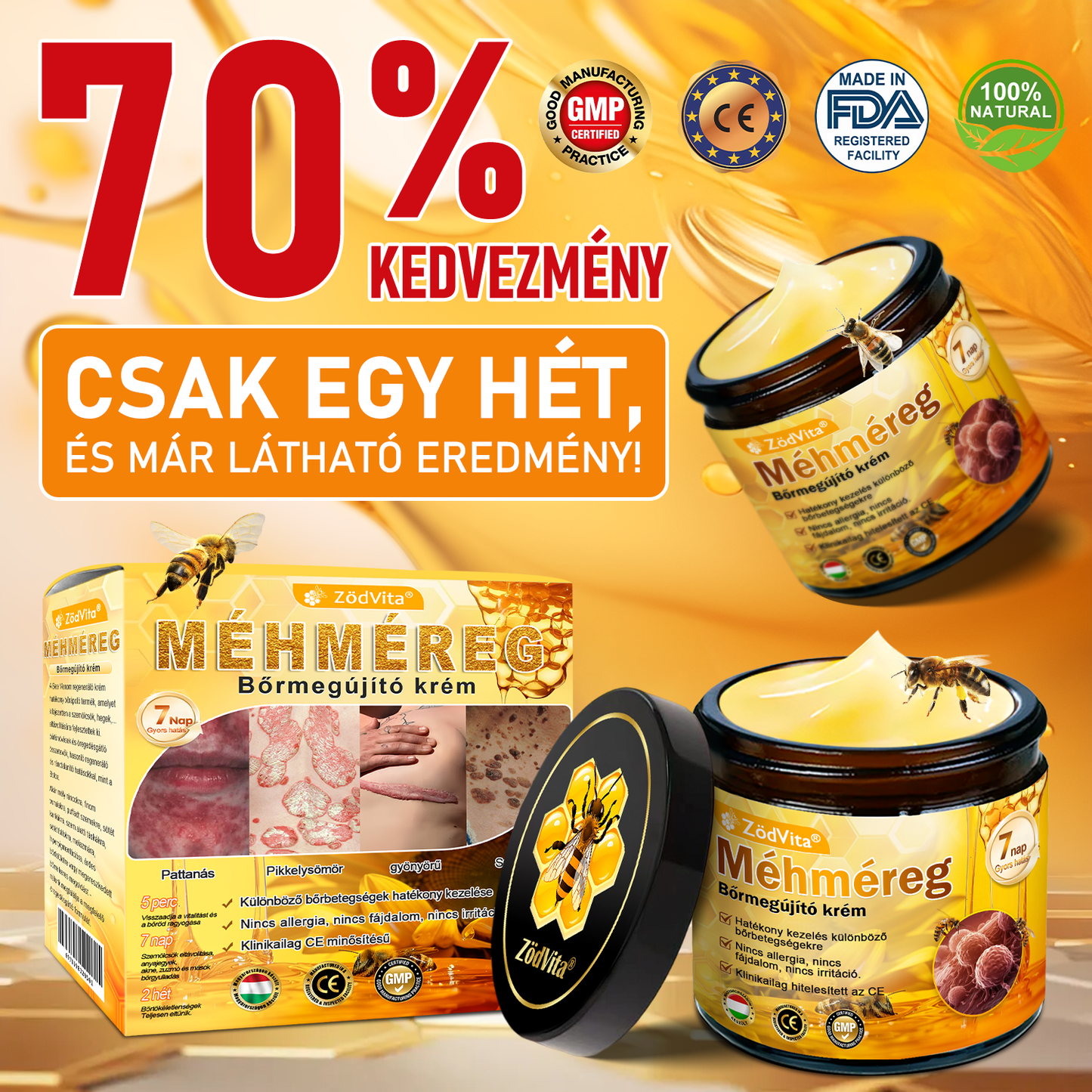🐝🌿 Bőrgyógyász ajánlása ✨ ZödVita® Méhméreg Bőr Helyreállító Krém 🔥 Magyar fejlesztés, magyarországi gyártás és szállítás
