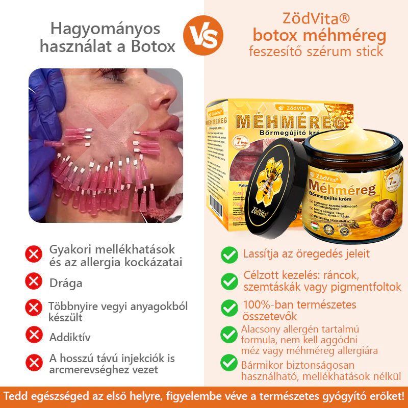 🐝🌿 ZödVita® Méhméreg Bőr Helyreállító Krém (👨‍⚕‍CE Tanúsítvány)👍✅