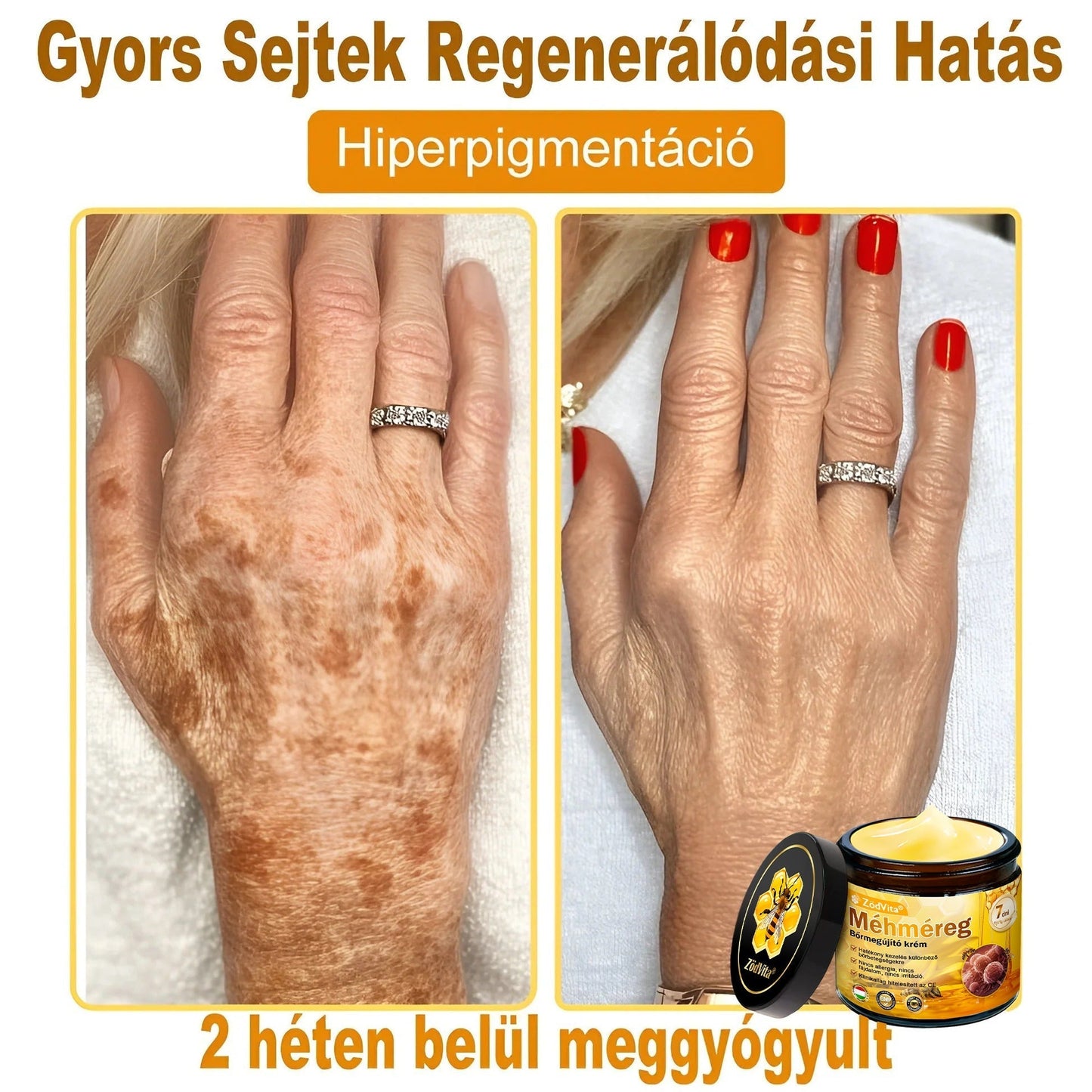 🐝🌸 Bőrgyógyász ajánlása ✨ ZödVita® Méhméreg Bőr Helyreállító Krém 🔥 Magyar fejlesztés, magyarországi gyártás és szállítás
