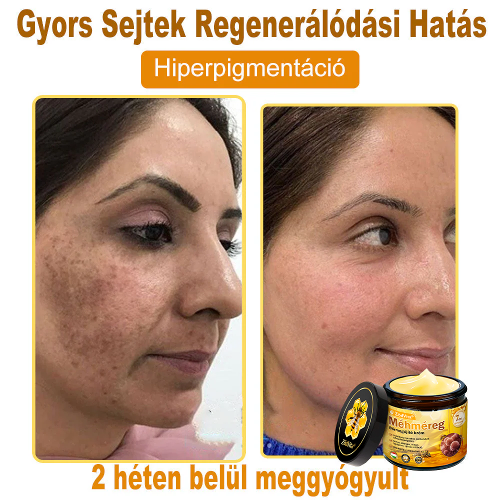 🐝🌿 ZödVita® Méhméreg Bőr Helyreállító Krém (👨‍⚕‍CE Tanúsítvány)👍✅